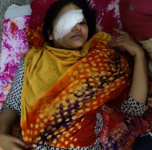 ফ্যানের আঘাতে চোখ হারালেন শিক্ষকা