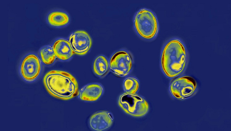 প্রাণঘাতী ছত্রাক ক্যানডিডা অরিসের সংক্রমণ দ্রুত বাড়ছে